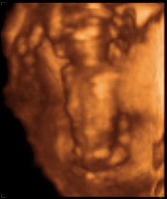 3d ultrasound image