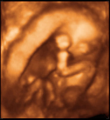 3d ultrasound image