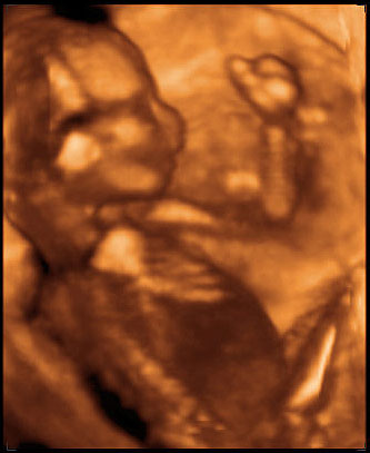 3d ultrasound image