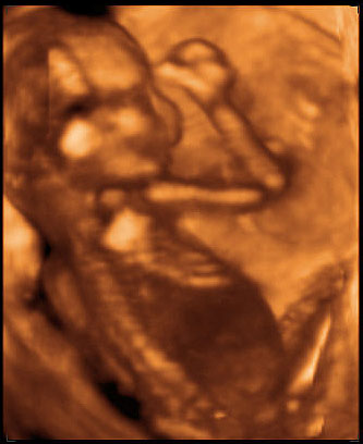 3d ultrasound image