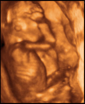 3d ultrasound image