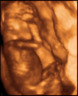 3d ultrasound image