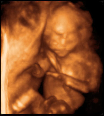 3d ultrasound image