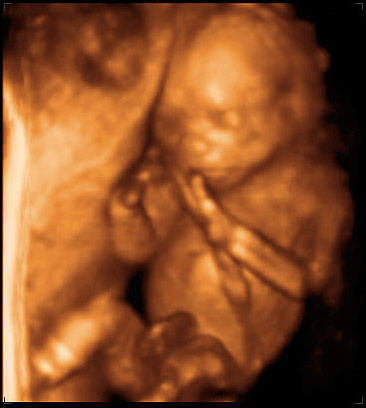 3d ultrasound image