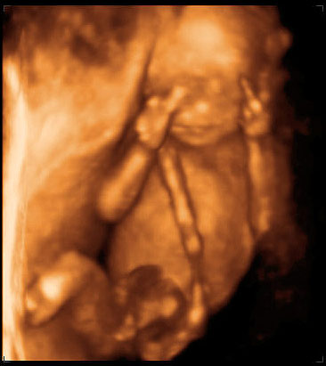 3d ultrasound image