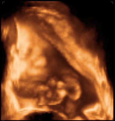 3d ultrasound image