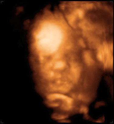 3d ultrasound image