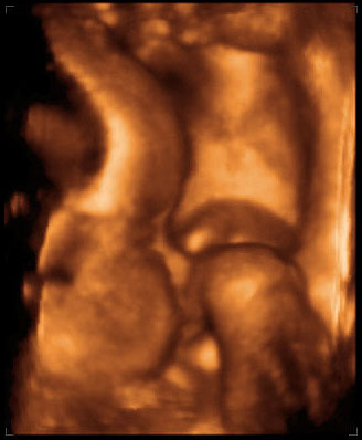 3d ultrasound image