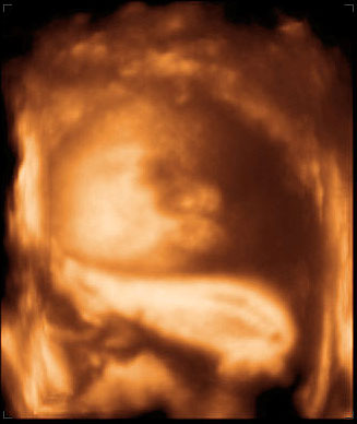 3d ultrasound image