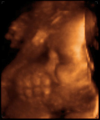 3d ultrasound image