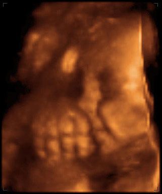 3d ultrasound image