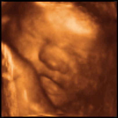 3d ultrasound image