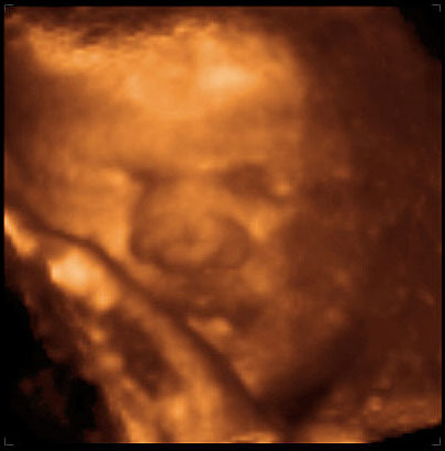 3d ultrasound image