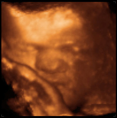 3d ultrasound image