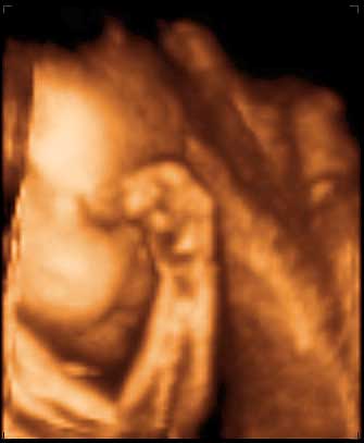 3d ultrasound image