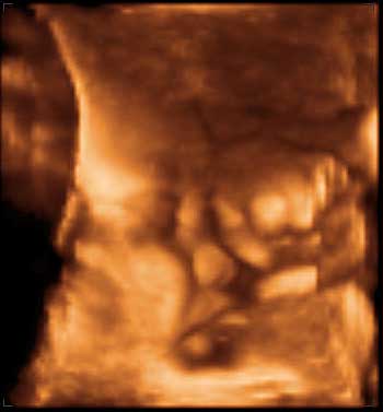 3d ultrasound image