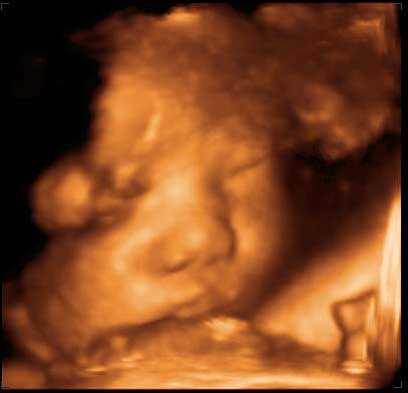 3d ultrasound image