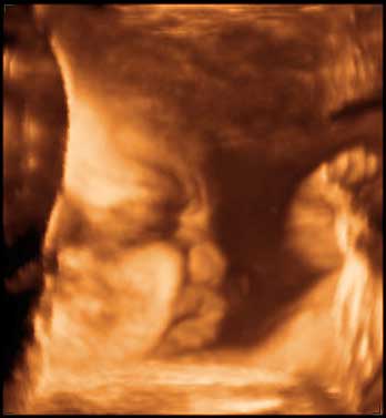 3d ultrasound image