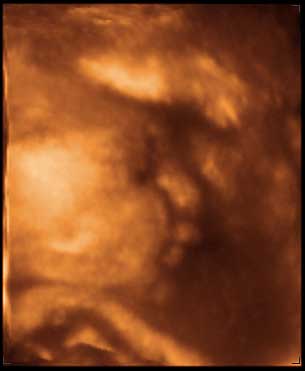 3d ultrasound image