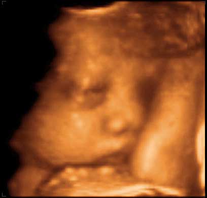 3d ultrasound image