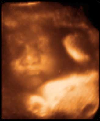 3d ultrasound image