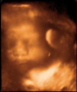 3d ultrasound image