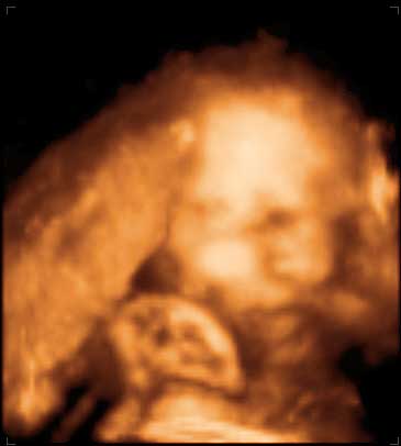 3d ultrasound image