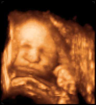 3d ultrasound image