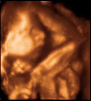 3d ultrasound image