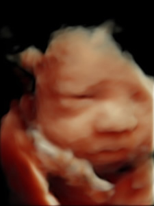 3D scan of a babies face