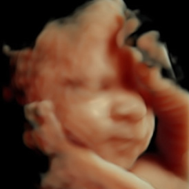 scan of babies face